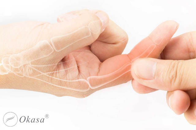 Phương pháp điều trị bệnh viêm khớp ngón tay